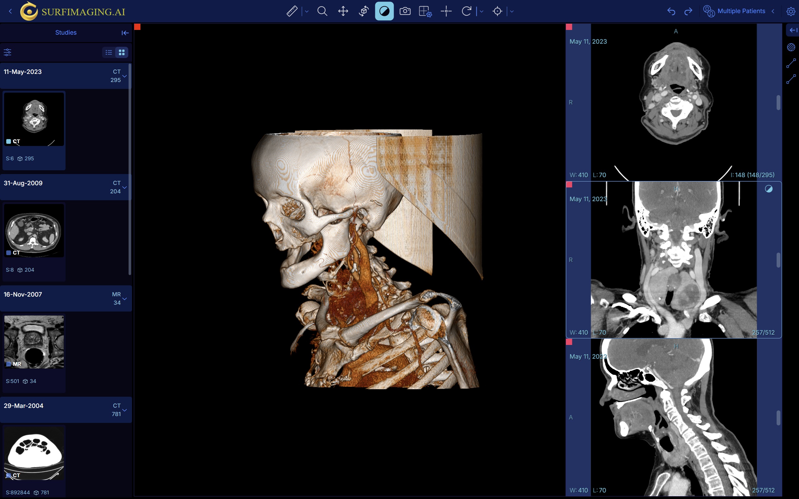 Head and Neck Basic View