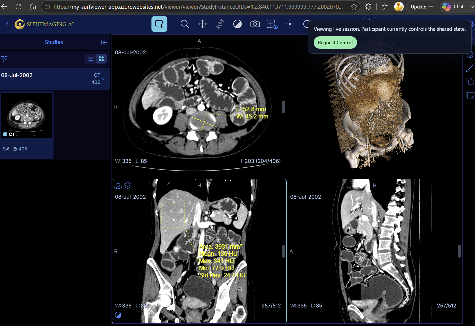 Multiple collaborators in a Surf Viewer workspace